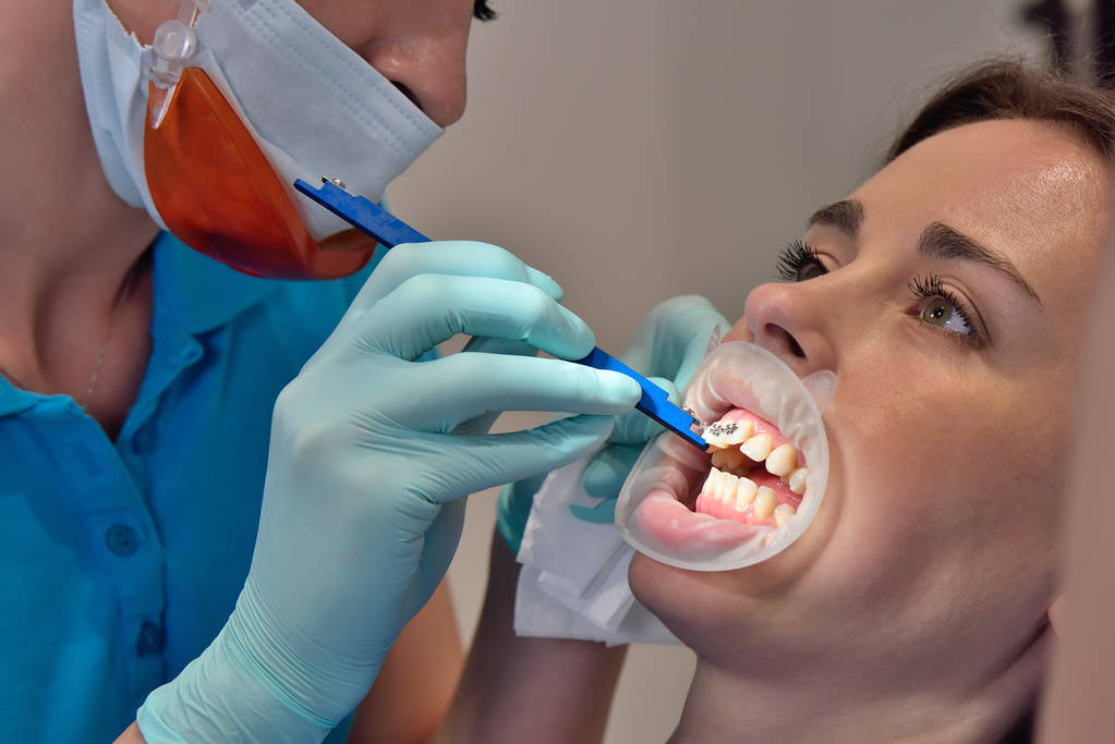 Inspección de la instalación de aparatos ortopédicos por el dentista
 - Foto, imagen