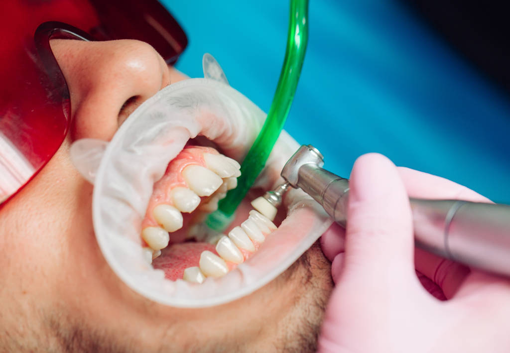 Nettoyage professionnel des dents. Le dentiste nettoie les dents d'un patient masculin. - Photo, image