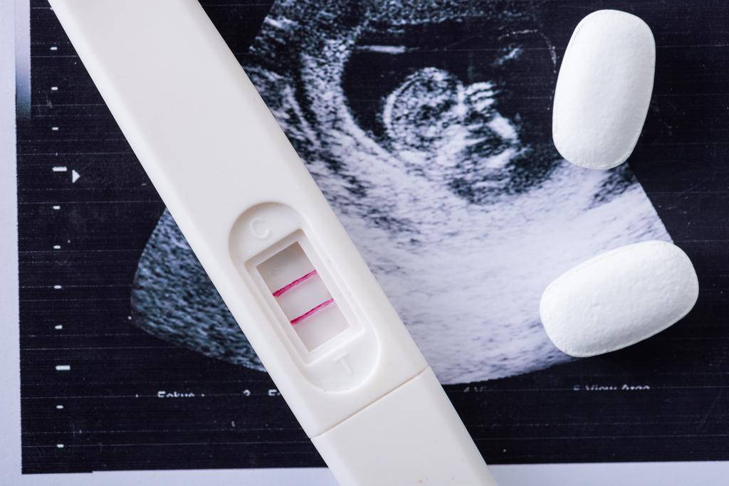 Close-up van pillen en zwangerschapstest op echografisch beeld  - Foto, afbeelding