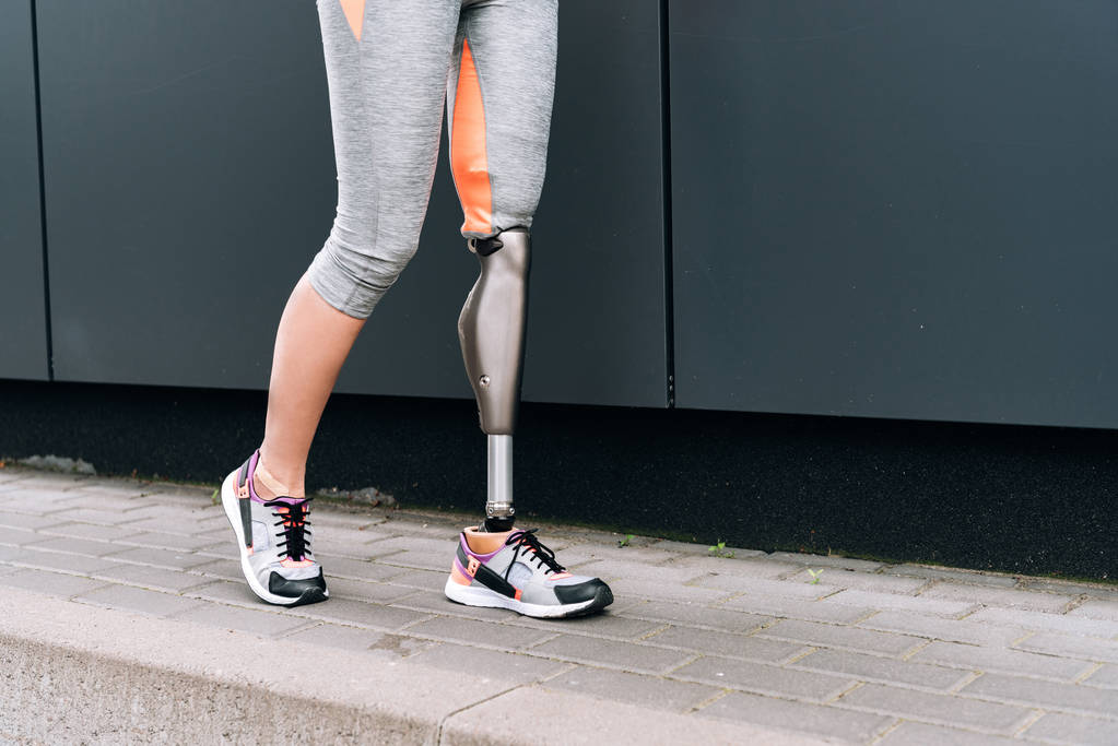 levágott kilátás mozgássérült sportoló protézissel az utcán - Fotó, kép