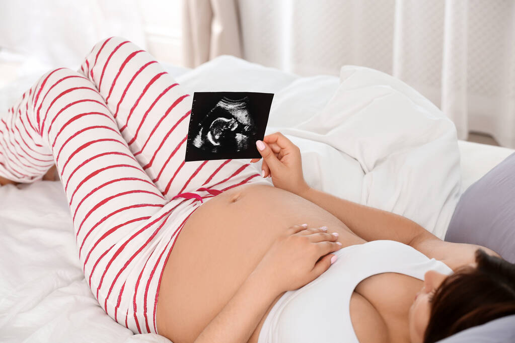 Zwangere vrouw met echografie foto op bed, close-up - Foto, afbeelding