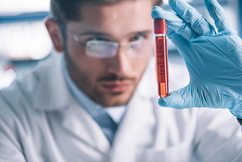 selectieve focus van bebaarde immunoloog die de reageerbuis met rode vloeistof vasthoudt  - Foto, afbeelding