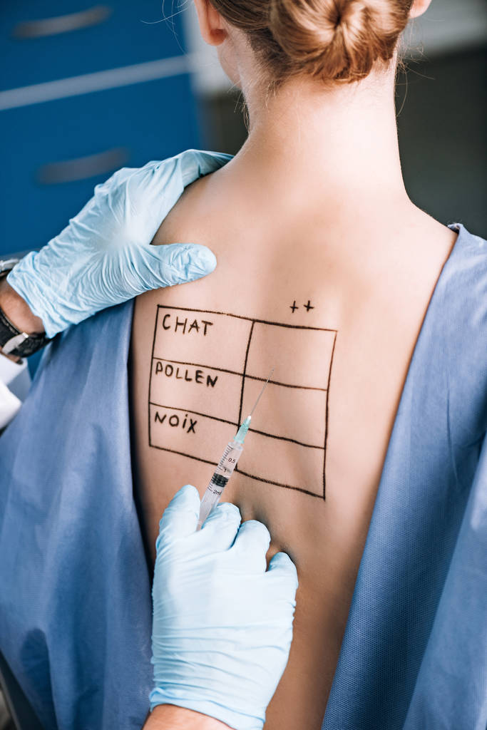 обрезанный вид аллерголога, держащего пипетку рядом с пациентом с письмами на отмеченном теле
  - Фото, изображение