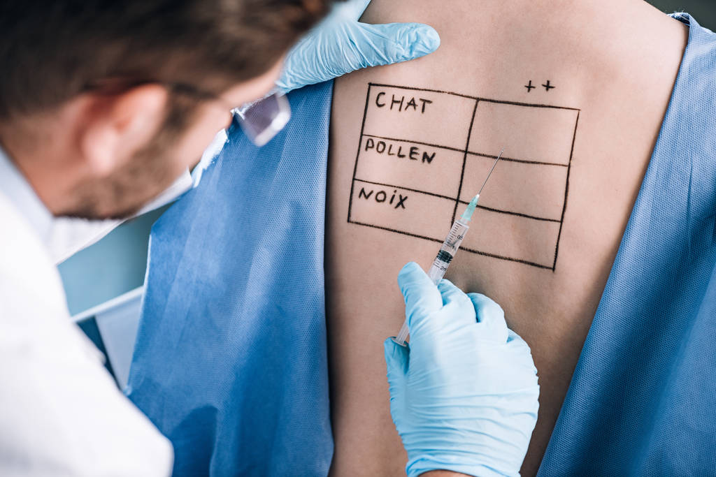 селективний фокус алерголога, який тримає піпетку біля пацієнта з літерами на позначеному тілі
  - Фото, зображення