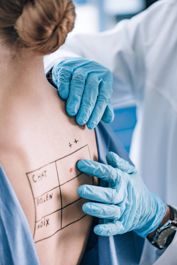 καλλιεργημένη άποψη του αλλεργιολόγου αγγίζοντας πίσω μέρος του ασθενούς με γράμματα και το σήμα - Φωτογραφία, εικόνα