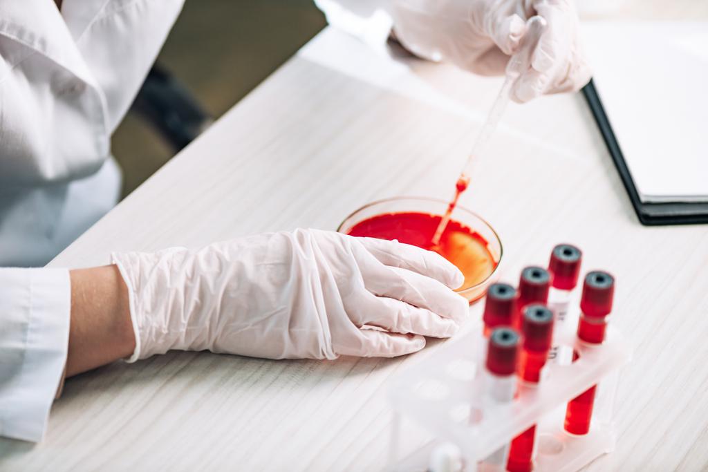 vue recadrée de l'immunologiste tenant une pipette avec du liquide rouge en laboratoire
  - Photo, image