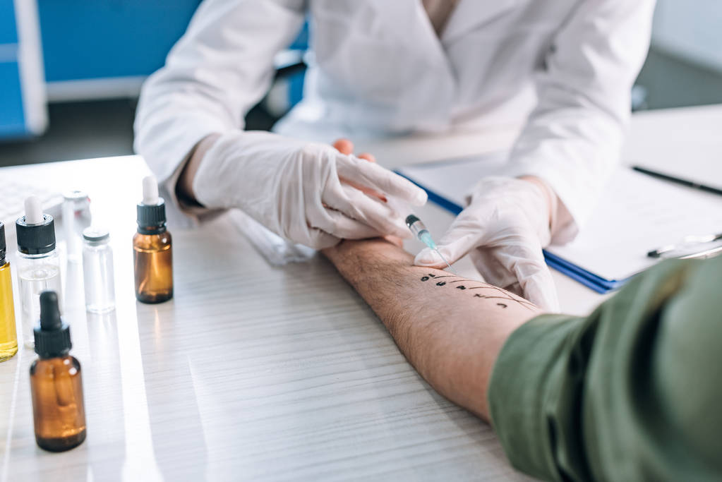 selective focus of allergist holding syringe near marked hand of patient  - Photo, Image