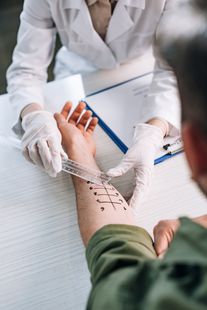 Allergologe in Latexhandschuhen hält Lineal in der Nähe markierter Hand auf Mann in Klinik  - Foto, Bild