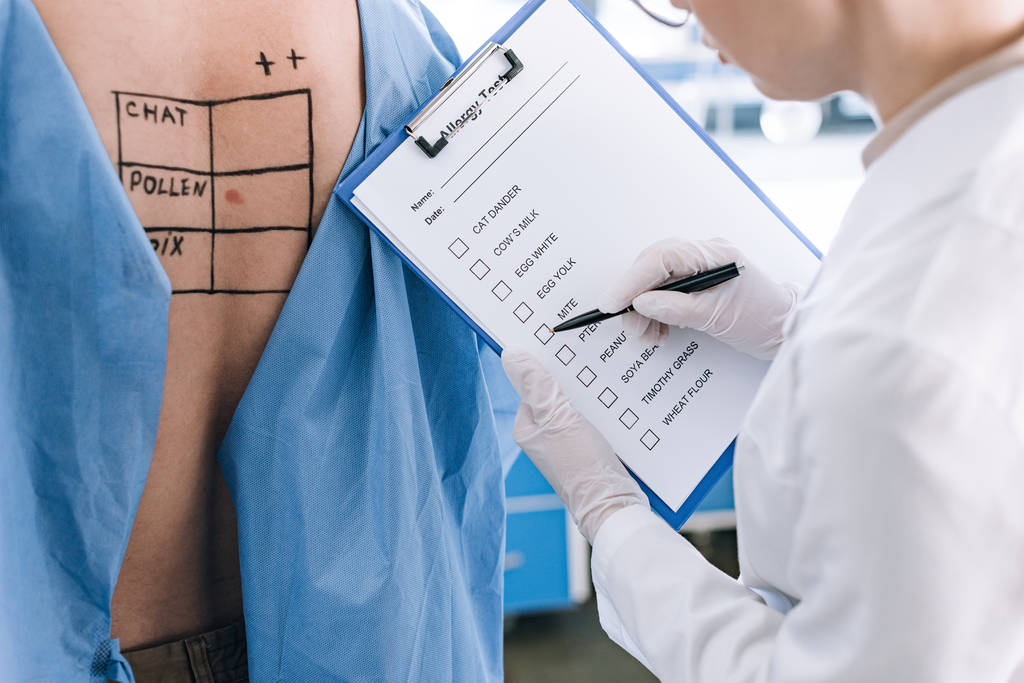 bijgesneden weergave van de allergisten houden pen in de buurt checklist terwijl het houden van klembord in de buurt van de patiënt  - Foto, afbeelding