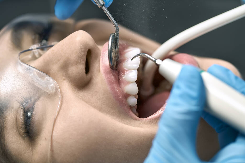 歯科医院でかわいい女性の歯のクリーニング - 写真・画像