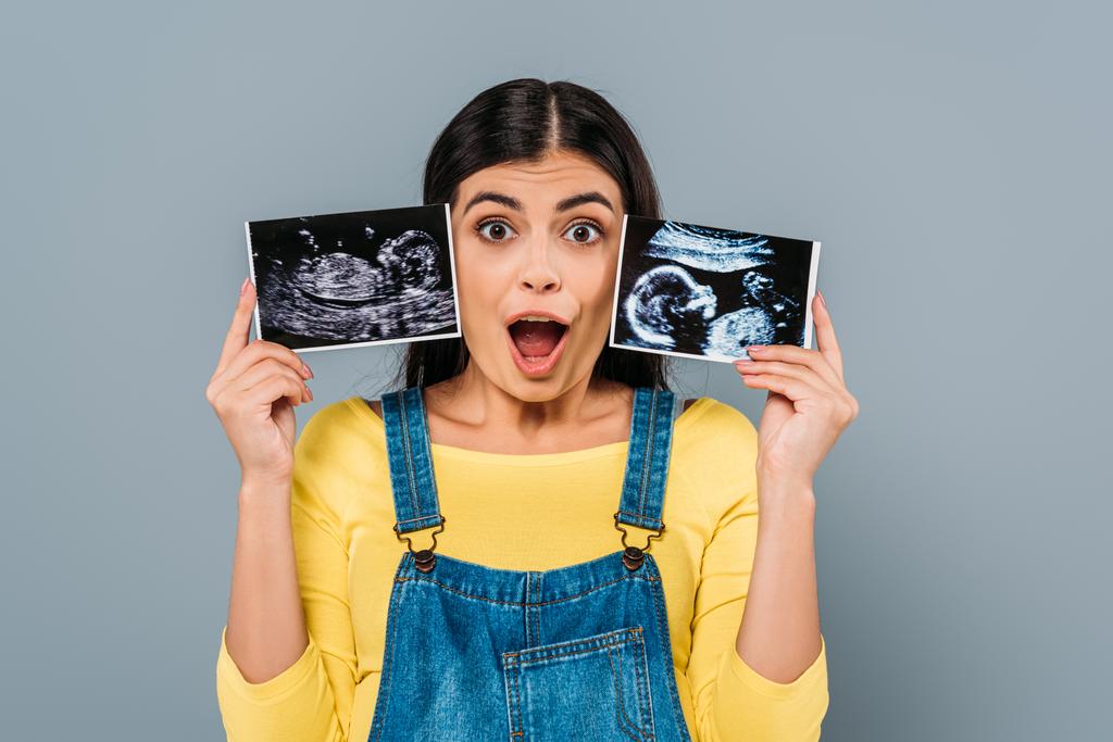shocked pregnant pretty girl holding fetal ultrasound images isolated on grey - Photo, Image