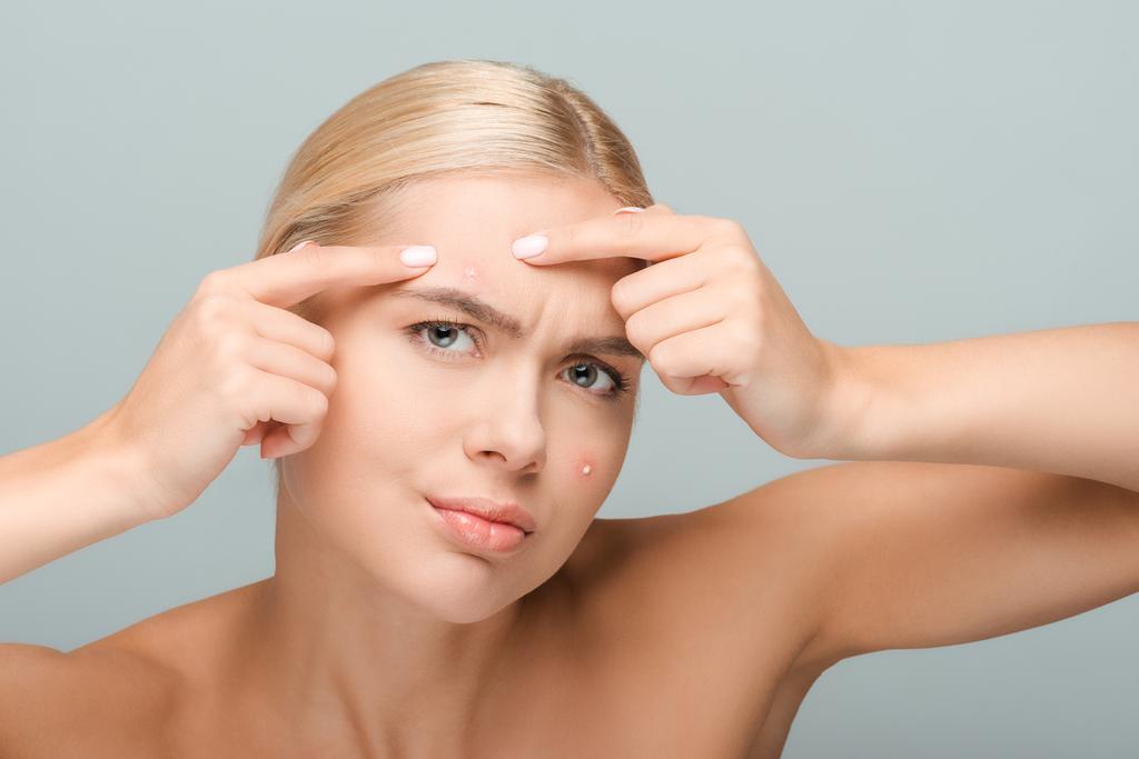 displeased girl pointing with fingers at face with acne isolated on grey  - Photo, Image