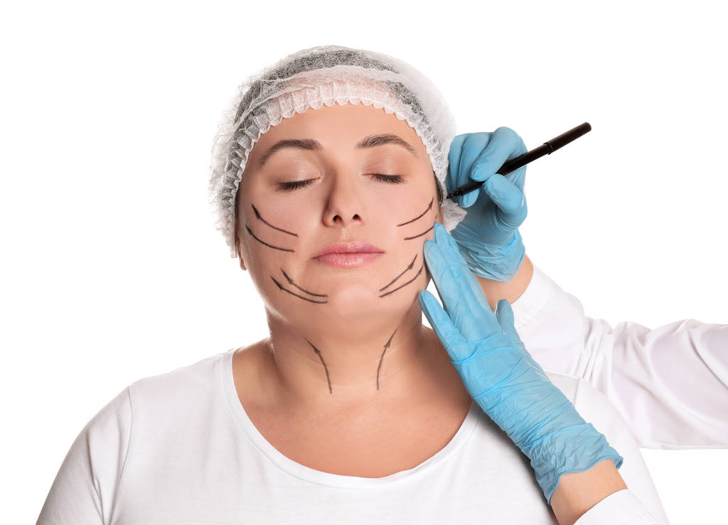 Lekarz rysujący ślady na twarzy kobiety do operacji chirurgii plastycznej - Zdjęcie, obraz