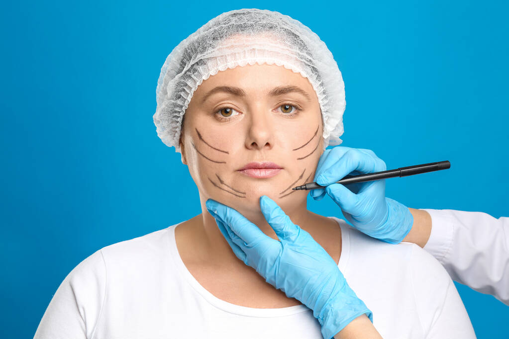 Dokter tekening tekens op het gezicht van de vrouw voor cosmetische chirurgie operat - Foto, afbeelding