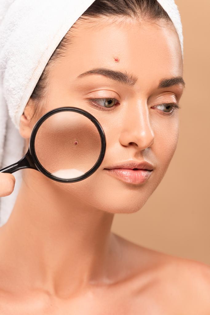young nude woman with pimples on face holding magnifier isolated on beige  - Photo, Image