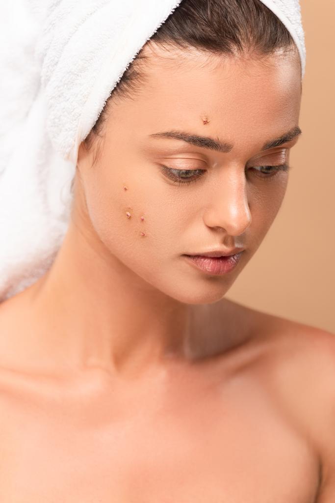 naked girl with pimples on face isolated on beige  - Photo, Image