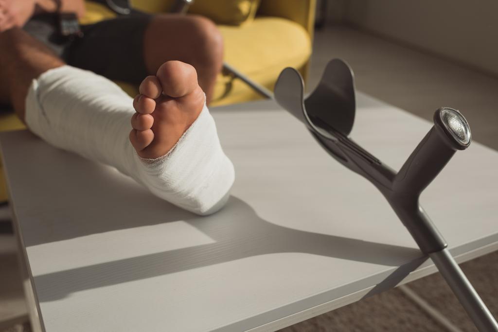 Ausgeschnittene Ansicht eines Mannes mit gebrochenem Bein auf Couchtisch in der Nähe der Krücke  - Foto, Bild