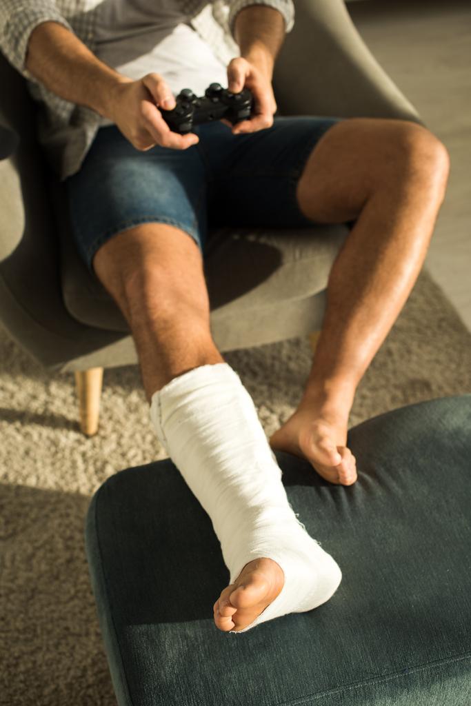 KYIV, UKRAINE - JANEIRO 21, 2020: Foco seletivo do homem com a perna quebrada jogando videogame em poltrona
 - Foto, Imagem