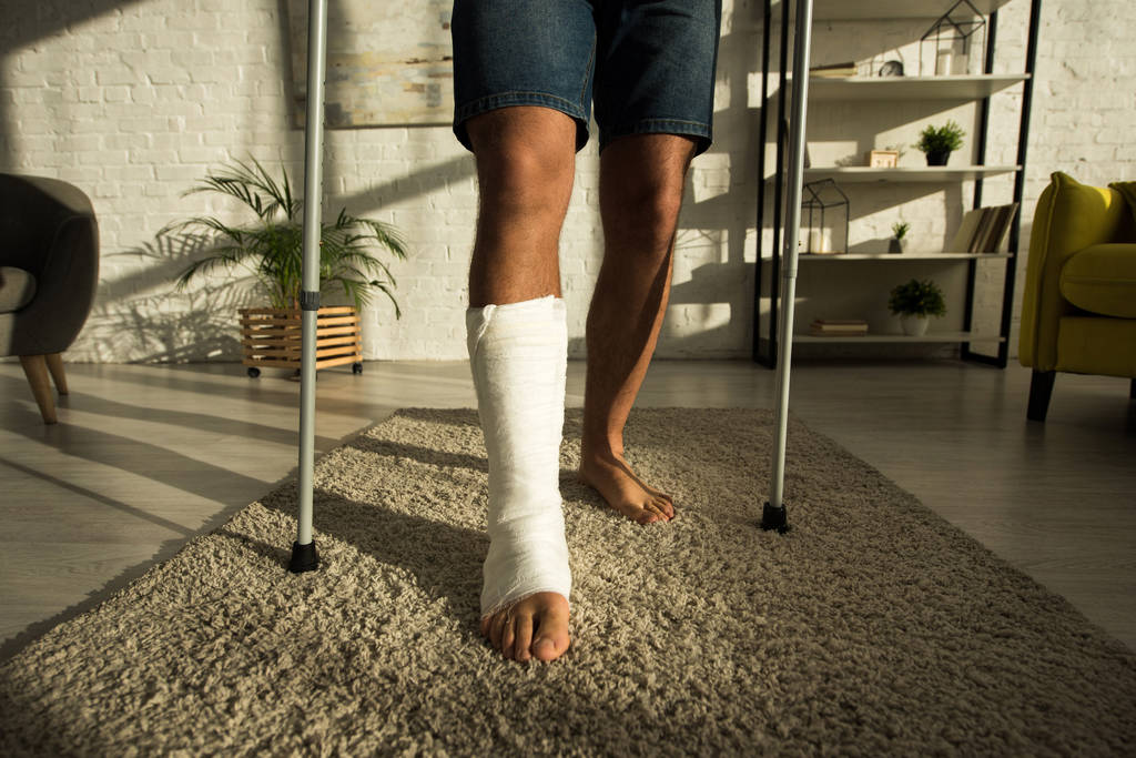 Вид человека со сломанной ногой, держащего дома костыли
 - Фото, изображение