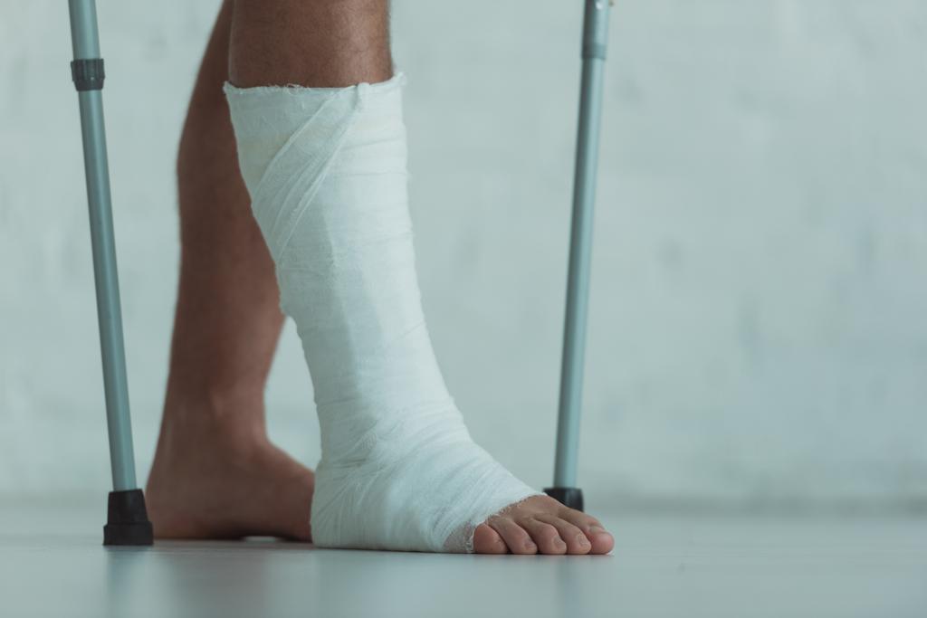 Cropped view of man with gypsum on leg holding crutches  - Fotoğraf, Görsel