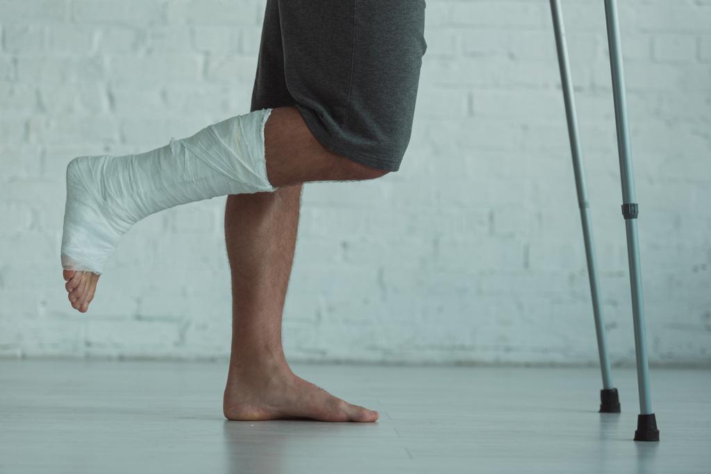 Vista lateral do homem com a perna em gesso bandagem segurando muletas
 - Foto, Imagem