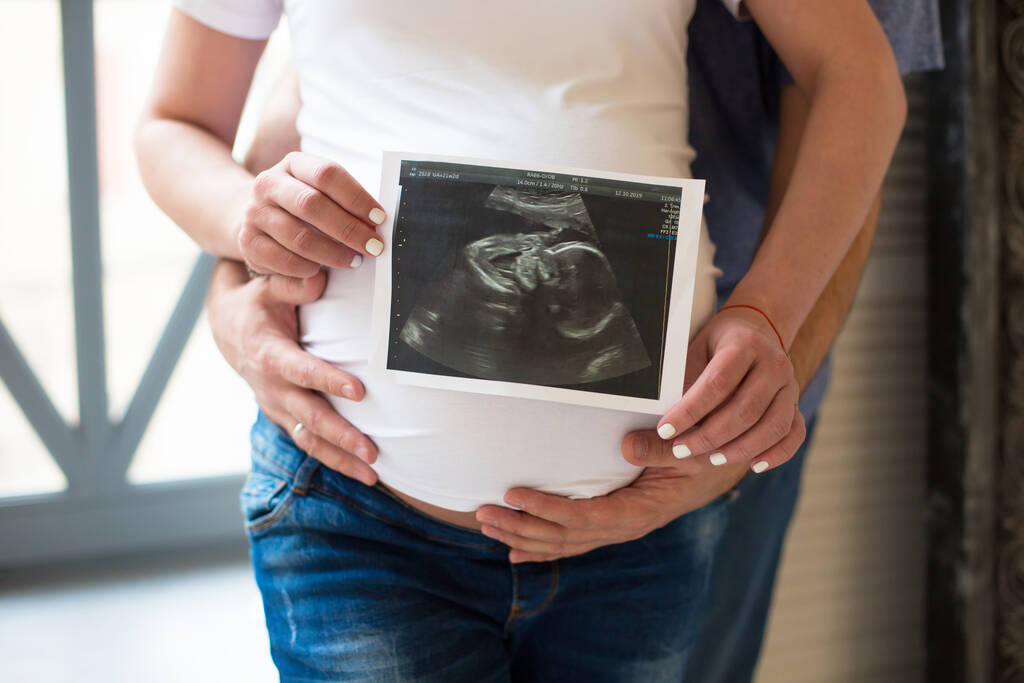 Pár tartsa Terhesség 3D-s fotó - Fotó, kép