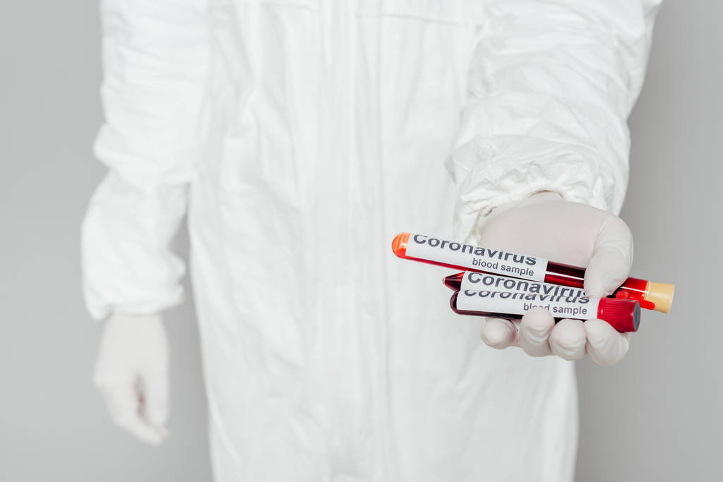 részleges kilátás epidemiológus vegyvédelmi ruha mutatja kémcsövek vérmintákkal szürke alapon - Fotó, kép