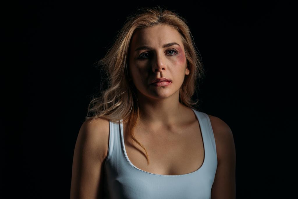 Woman with bruises on face looking at camera isolated on black  - Photo, Image