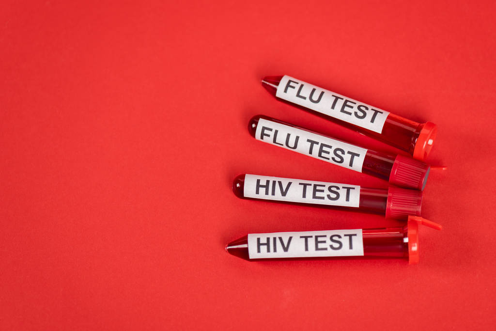 vista superior de los tubos de ensayo con la prueba de VIH y la inscripción de la prueba de gripe en rojo
  - Foto, imagen