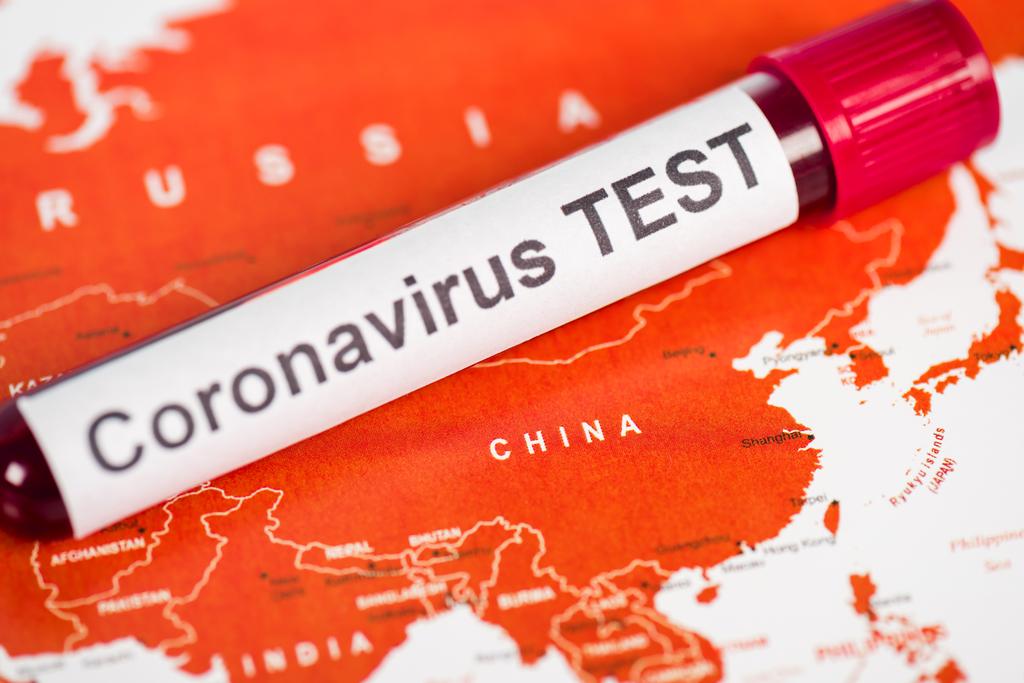 close up of sample with coronavirus test lettering on map  - Photo, Image