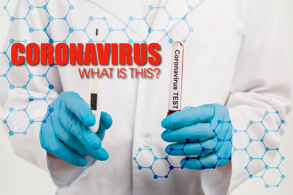 bijgesneden weergave van wetenschapper die monster met coronavirus test en digitale thermometer in de buurt van coronavirus wat is dit belettering op wit  - Foto, afbeelding
