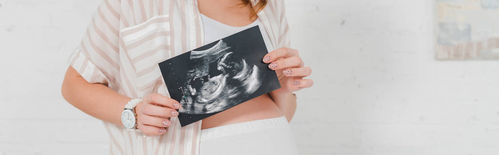 Vista ritagliata della ragazza incinta che mostra l'ecografia del bambino, colpo panoramico
 - Foto, immagini