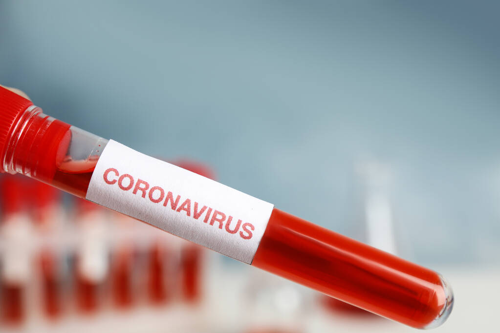 Tubo de ensayo con muestra de sangre y etiqueta VIRUS DE CORONA en laboratorio, primer plano
 - Foto, Imagen