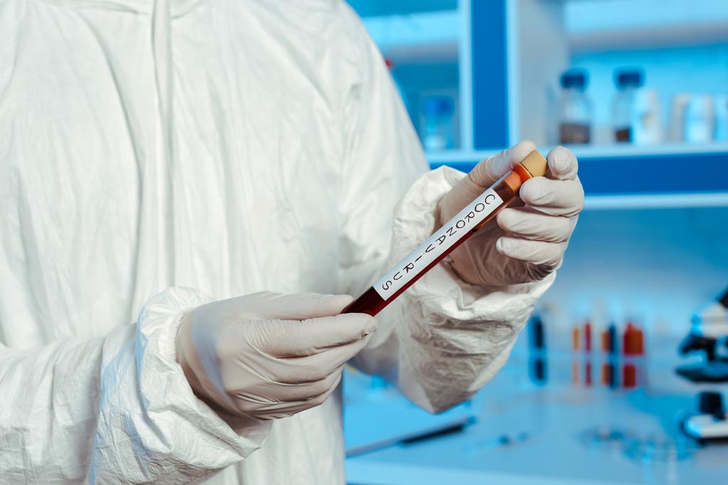 καλλιεργημένη άποψη του επιστήμονα σε γάντια λατέξ κρατώντας δοκιμαστικό σωλήνα με γράμματα coronavirus  - Φωτογραφία, εικόνα