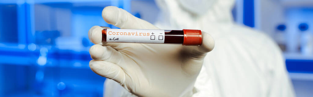 plano panorámico de científico en guante de látex sosteniendo muestra con letras de coronavirus
  - Foto, imagen