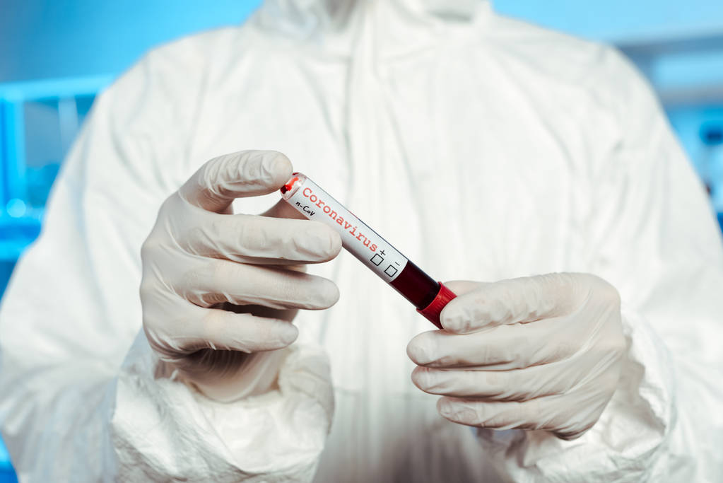 селективный фокус ученого в латексных перчатках, держащих образец с коронавирусной надписью
  - Фото, изображение