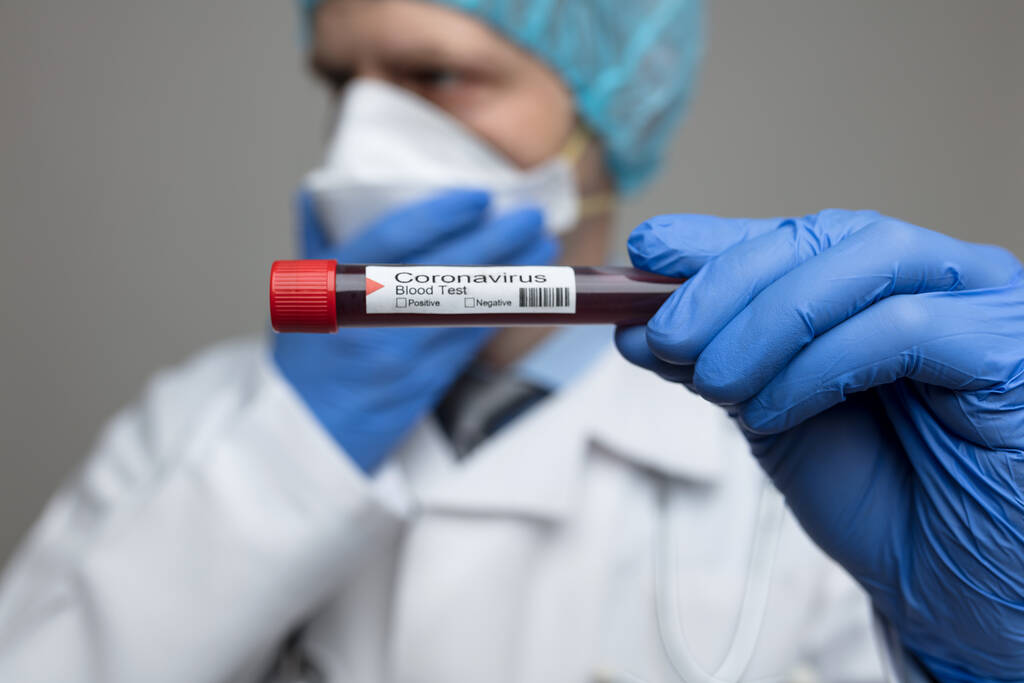 Trabajador de la salud usando una máscara respiratoria, sosteniendo la muestra de análisis de sangre del Coronavirus Covid-19
,  - Foto, imagen