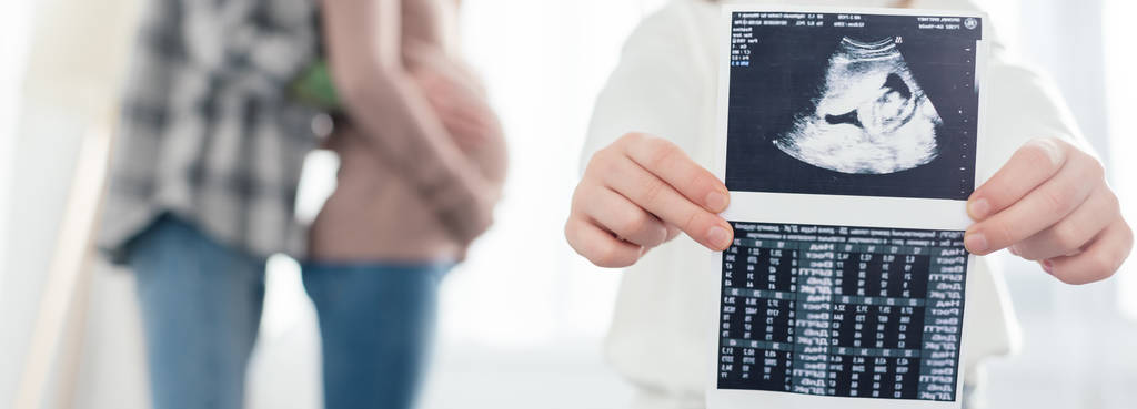 Cropped view of child holding ultrasound scan of baby while woman embracing pregnant girlfriend at home, panoramic shot  - Photo, Image