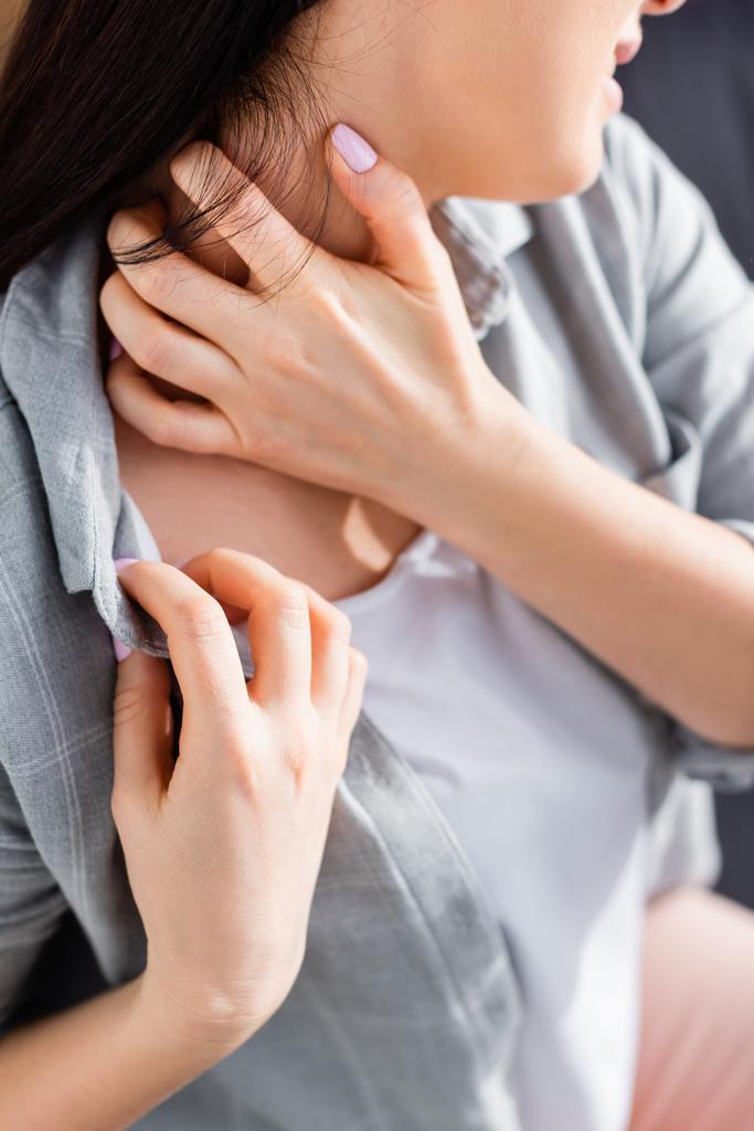 cropped view of allergic woman scratching neck  - Photo, Image
