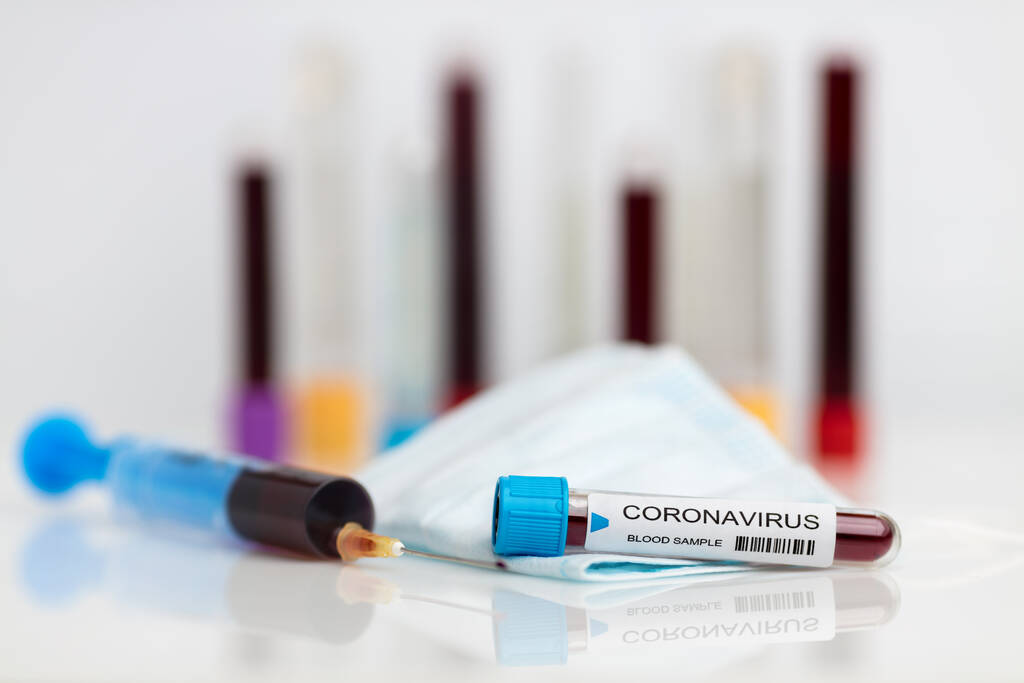 Testing the laboratory sample of the novel Coronavirus  - Photo, Image