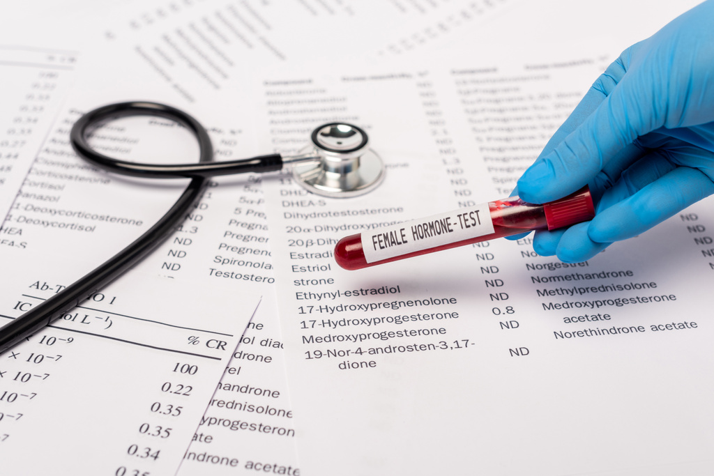 Обрезанный взгляд врача, держащего пробирку с женским гормональным тестом возле стетоскопа и списки с гормонами
 - Фото, изображение