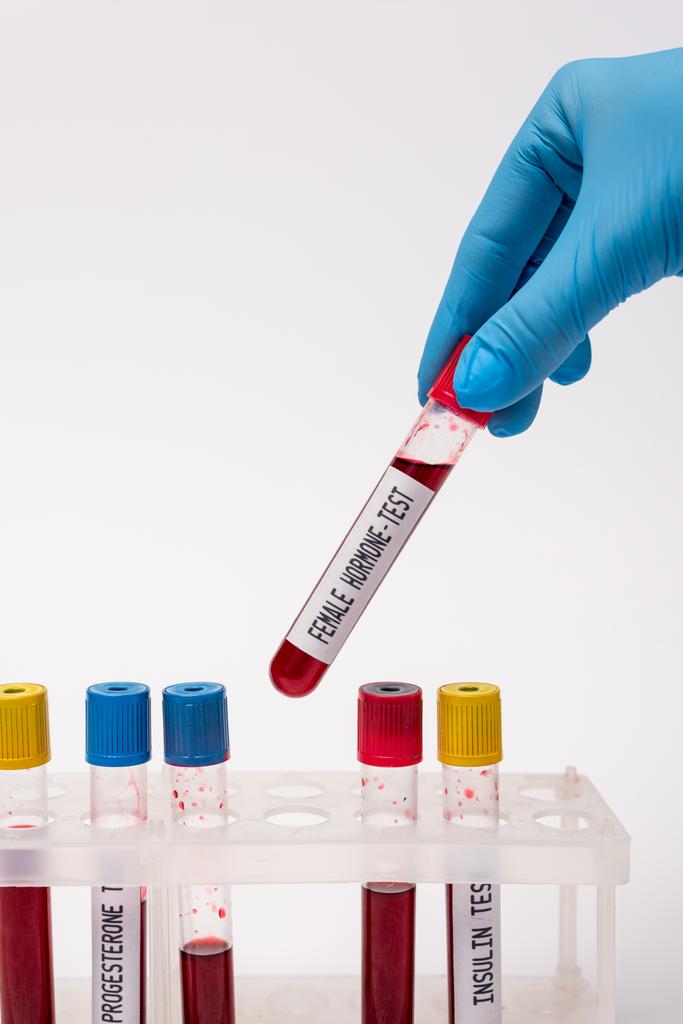 Обрізаний вид лікаря, який тримає пробну трубку з жіночим гормональним тестом біля зразків крові в підставці ізольовано на білому
  - Фото, зображення