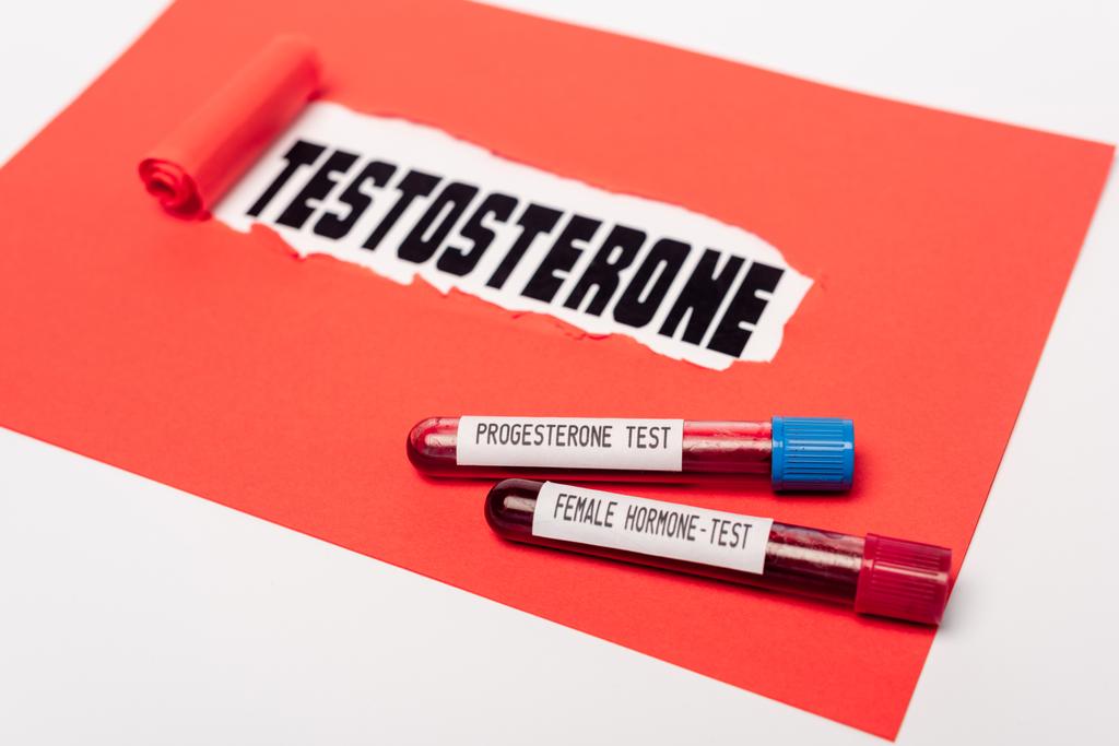 Visão de perto dos tubos de ensaio com progesterona e amostras de sangue de hormona feminina perto de papel vermelho com letras de testosterona sobre fundo branco
 - Foto, Imagem