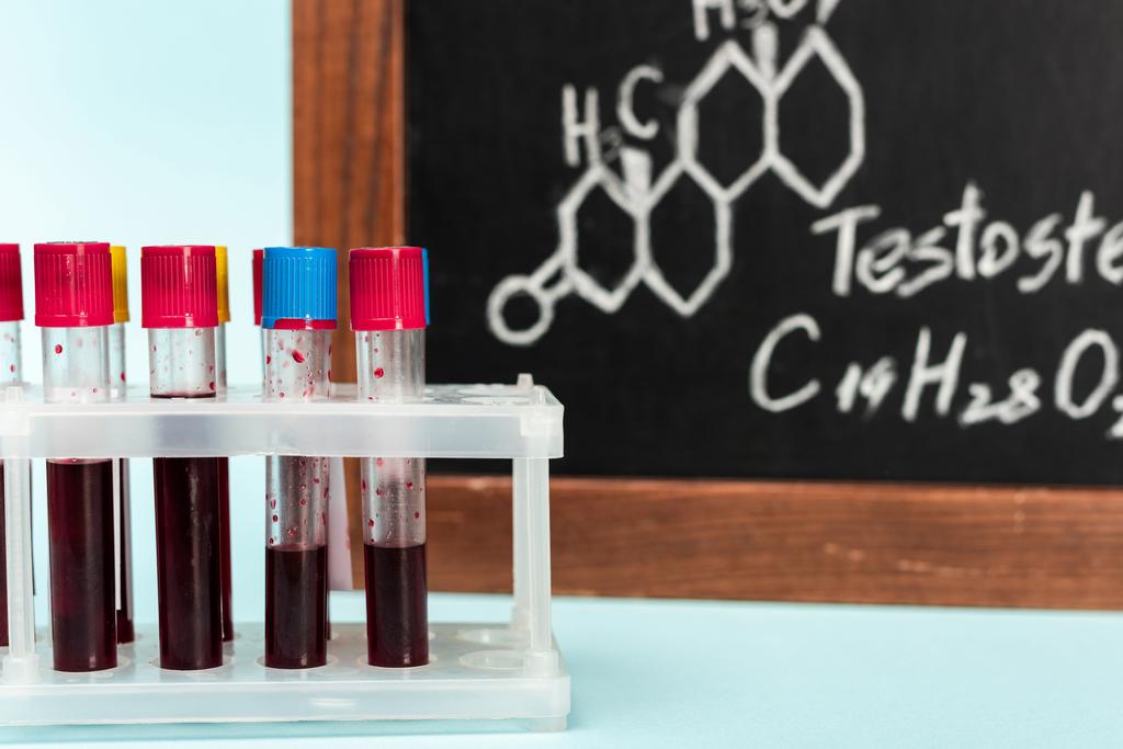 Foco seletivo de suporte com amostras de sangue em tubos de ensaio perto de quadro negro com fórmula de testosterona em fundo azul
 - Foto, Imagem