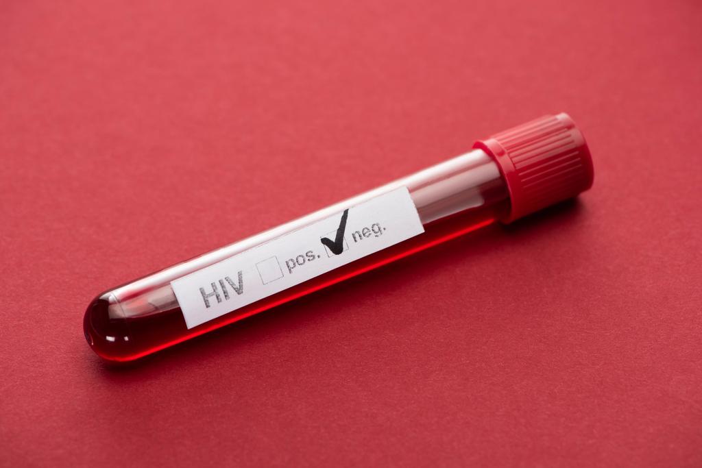 Kırmızı arkaplanda negatif HIV kan testi - Fotoğraf, Görsel