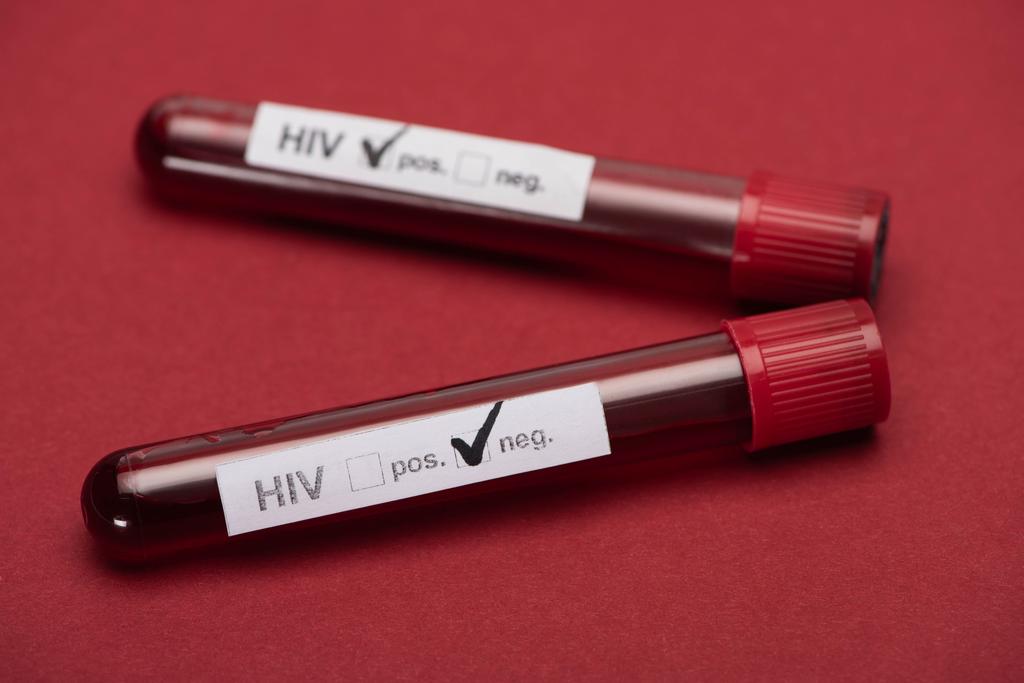selective focus of negative and positive hiv blood sample test on red background - Photo, Image