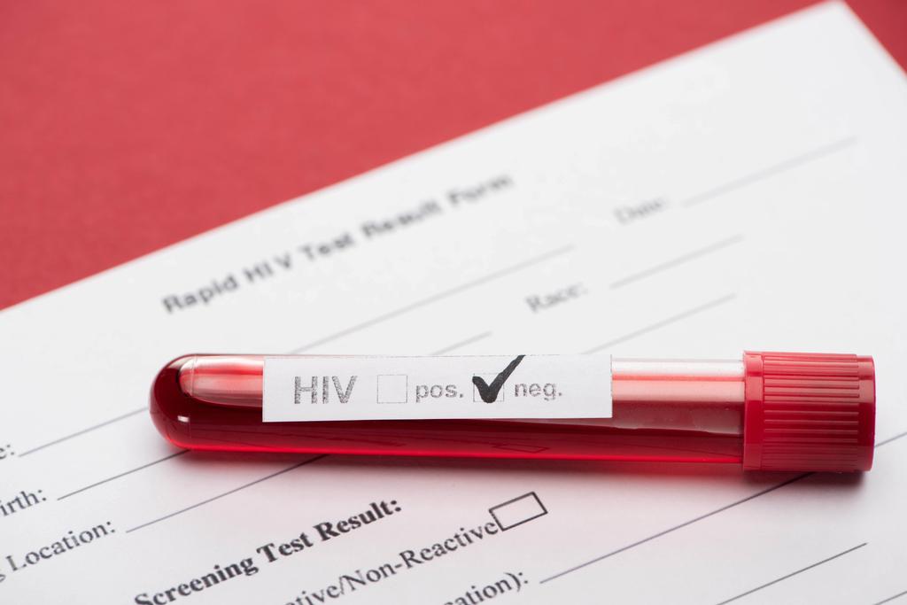 Kırmızı zemin üzerinde negatif HIV kan örneği olan hızlı HIV test formu - Fotoğraf, Görsel