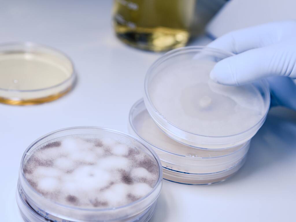 Una inyección de primer plano de un trabajador de laboratorio que examina una sustancia en una placa de Petri mientras lleva a cabo la investigación del coronavirus
 - Foto, imagen