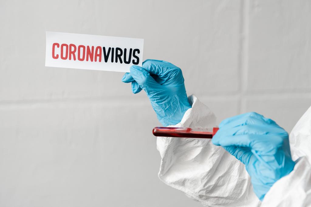 vista recortada de la persona en guantes de látex con tarjeta de coronavirus y muestra de sangre
 - Foto, Imagen