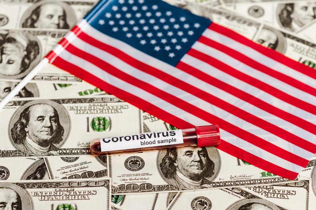 ドル紙幣のアメリカ国旗とコロナウイルスの血液サンプル、経済危機の概念 - 写真・画像
